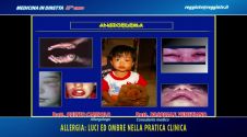 Allergia: luci ed ombre nella pratica clinica