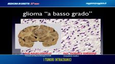 I tumori intracranici